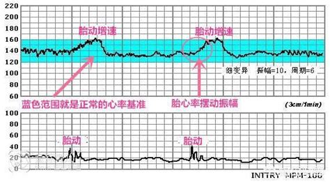 孕36周胎心监护5分合格吗