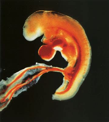 怀孕16周的胎儿有多大图片