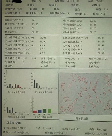 医院怀孕报告单图片