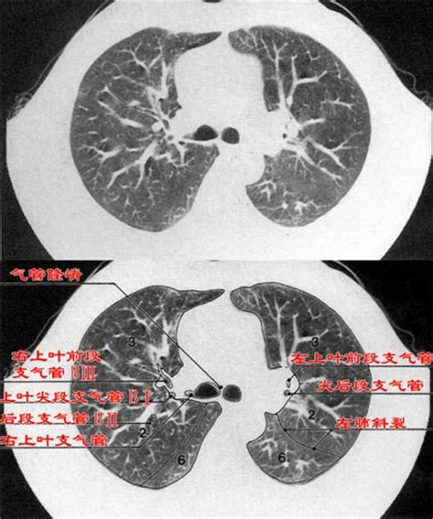 如何判断胎儿肺部是否发育好了