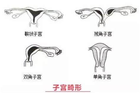 复发性流产后需要做哪些检查