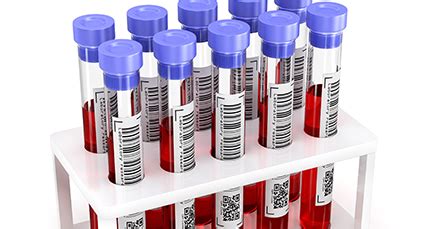 孕检报告正常但是没右臂