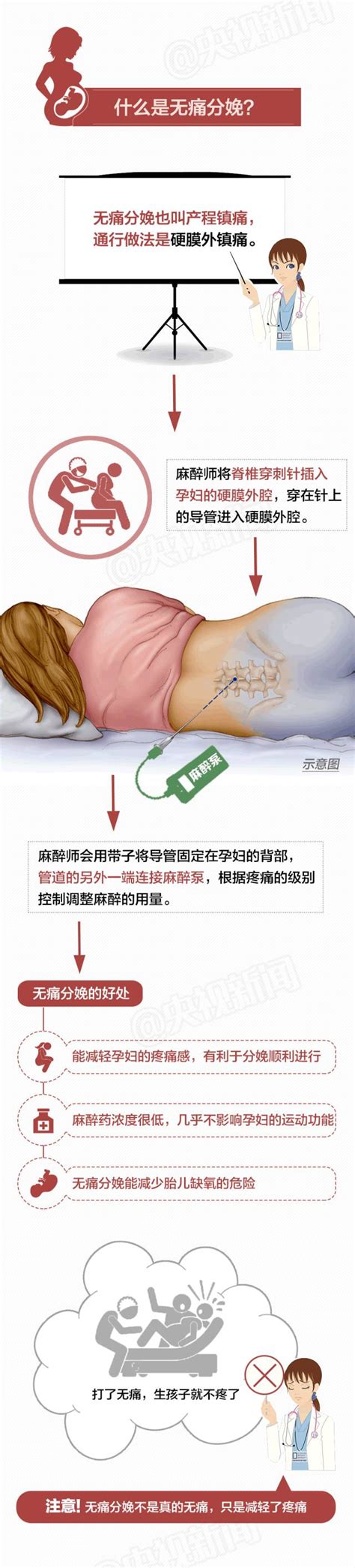 怀孕接近四个月做引产手术痛不痛