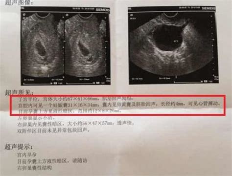 孕期5周胎儿发育情况