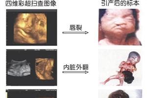 孕期各月看胎儿的发育特征