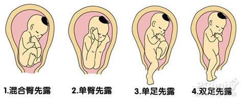 孕妇怀孕第三个月注意事项