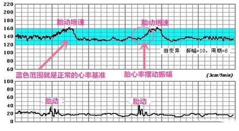 发烧胎心180有危险吗