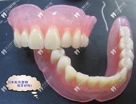 树脂活动假牙与塑钢活动假牙优劣