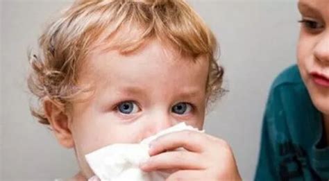 小儿鼻窦炎常年脓鼻涕