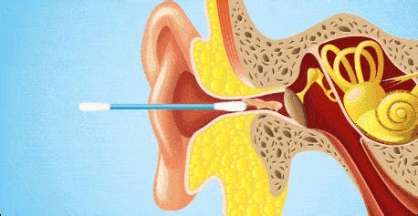 经常用棉签淘耳,有危害吗?