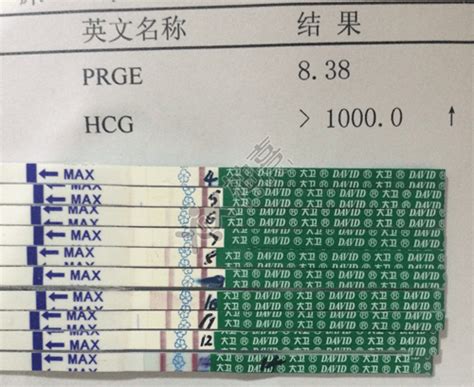 囊胚移植14天hcg值120