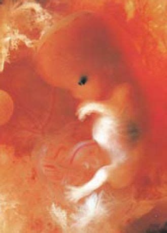 怀孕八个月了的胎儿图