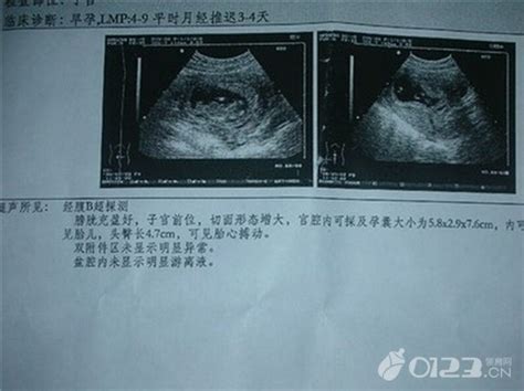 宫寒怀孕对宝宝有什么伤害