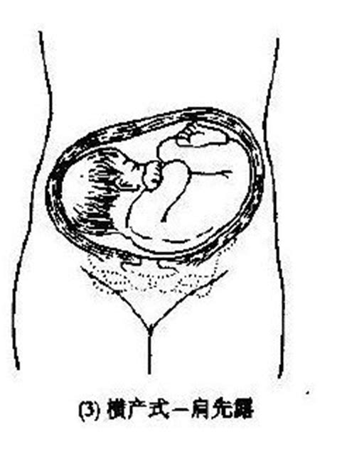 如何在孕期长胎不长肉
