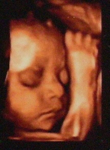 怀孕第四个月的胎儿有多大