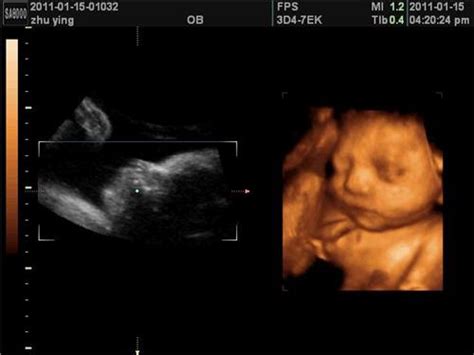 怀孕五个月四维图片