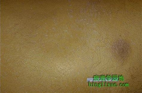 小孩皮肤怎么去黄