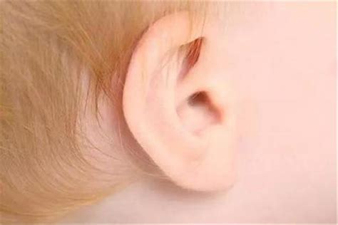 遗传性聋都属于先天性聋