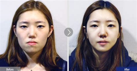 鞋拔子臉女孩子面相怎么樣