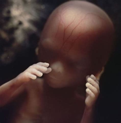 胎儿发育过程真人图