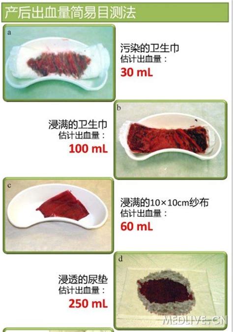大血块流出并且大量出血