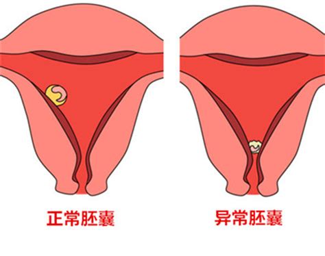 孕囊与胎芽生长比例表