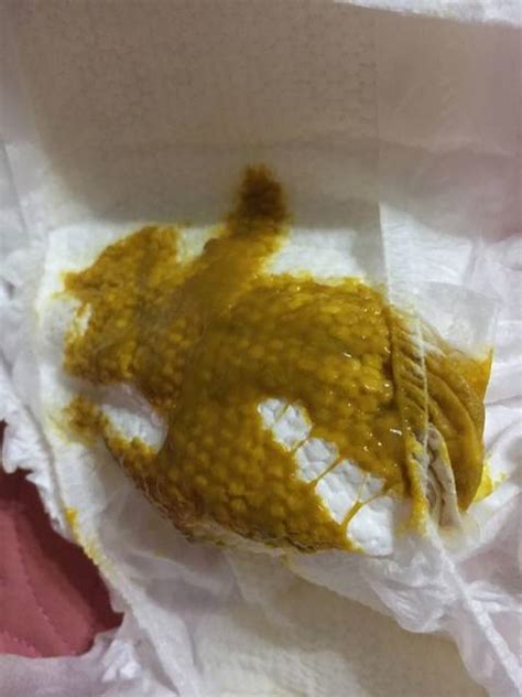 宝宝吃了辅食拉的便便粘液