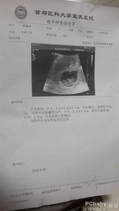 怀孕一个月到十个月的b超照片