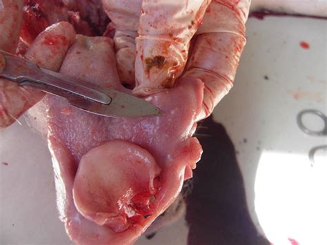 右侧胯骨有个疙瘩