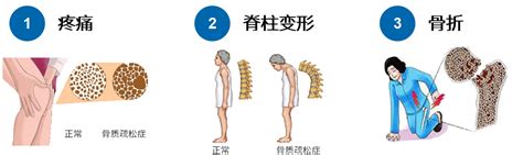 骨头疼补什么钙