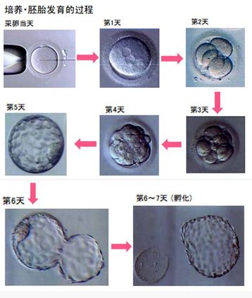 胚胎等级怎么划分 数字