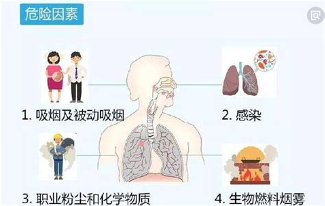 治疗支气管炎哮喘偏方