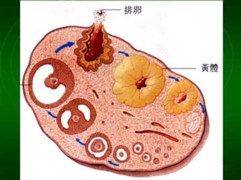 右卵巢多囊样改变是什么意思啊