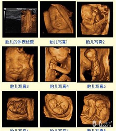 怀孕17周胎儿有多大