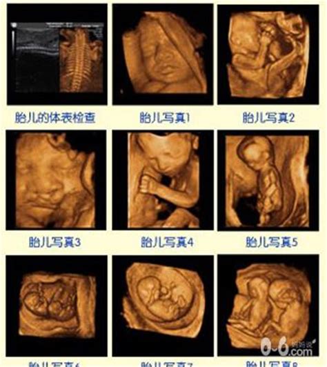 6个月大的胎宝宝发育的样子