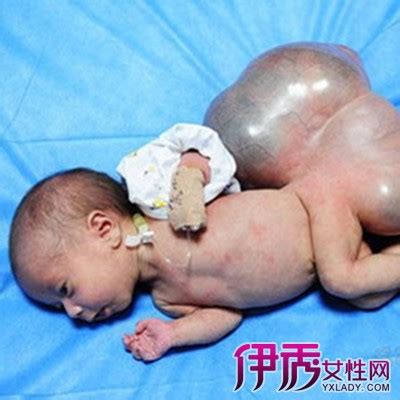 生完孩子禁忌吃什么