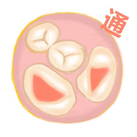 做四维心脏三尖瓣轻度反流