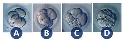 胚胎等级4bc移植成功率