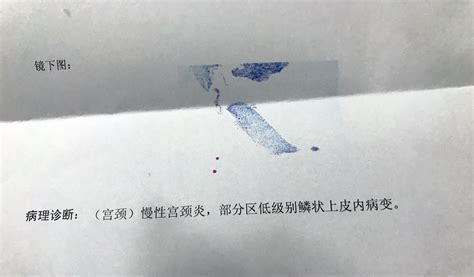 怀孕39周什么方法快点生