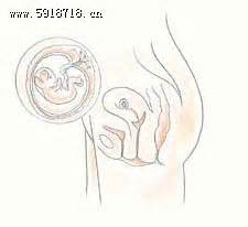怀孕11周胎儿大小图片