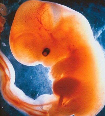 怀孕一个月胎儿图片