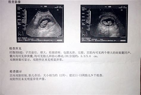 45天怀孕b超图