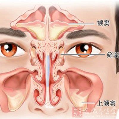 孕妇鼻塞流鼻涕小秘方