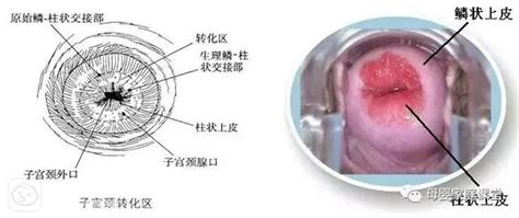 子宫长49mm正常吗