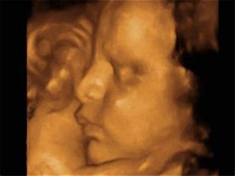 妊娠三个月胎儿的发育