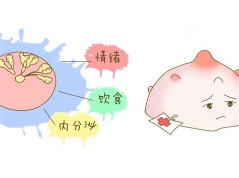 哺乳期乳腺炎会自愈吗