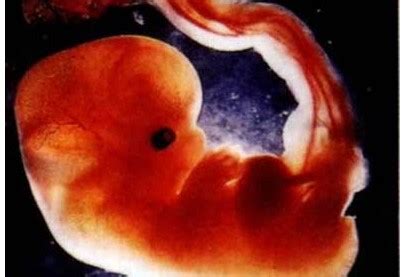 怀孕42天胎儿图片可爱