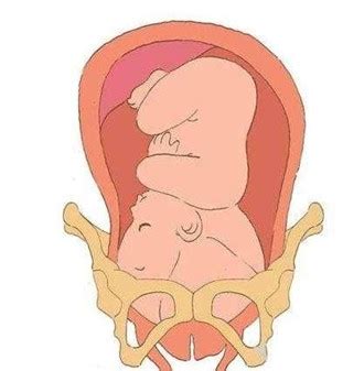 孕37周臀位还能正常吗