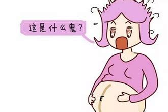 妊娠线不明显的生女孩