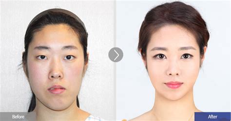 鞋拔子臉什么意思?